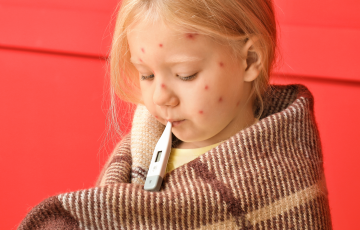 Sarampo cresce 32 vezes nas Américas em um ano; veja situação do Brasil